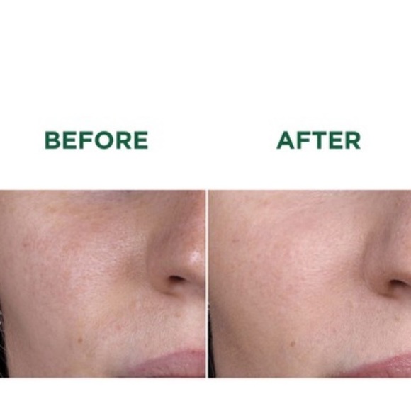 Klorane Soothing Organic Peony Stick Mask - Picture 6 of 9